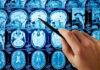 Hand pointing at brain scan images on screen