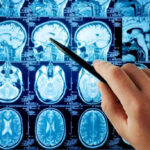 Alarming Brain-Aging Trigger – Invisible Danger Revealed Hand pointing at brain scan images on screen