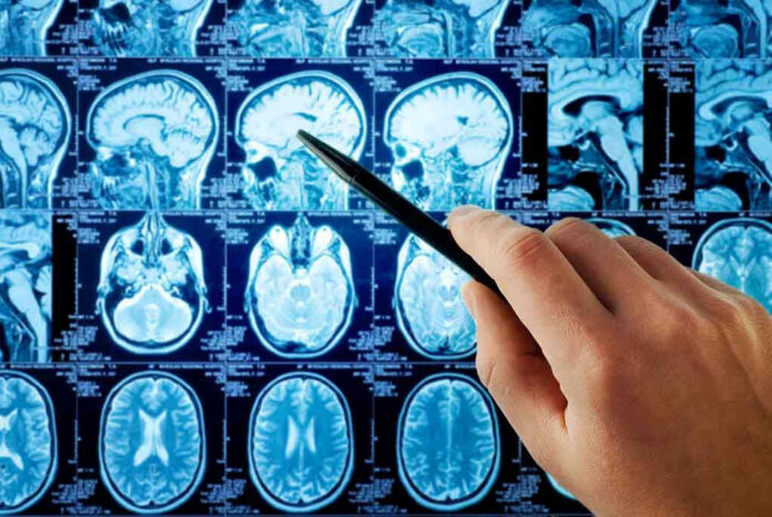 118491940 Hand pointing at brain scan images on screen