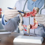 Colorectal Tests Turned Upside Down By Poop Doctor pointing at anatomical model of the colon