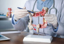 Doctor pointing at anatomical model of the colon