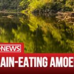 Central NC teen infected with 'brain-eating' amoeba